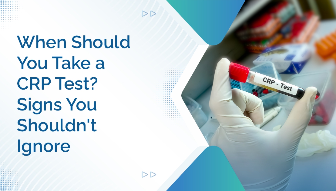 When Should You Take a CRP Test? Signs You Shouldn’t Ignore
